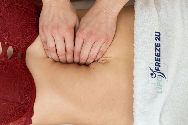 diastasis recti treatment Folkestone