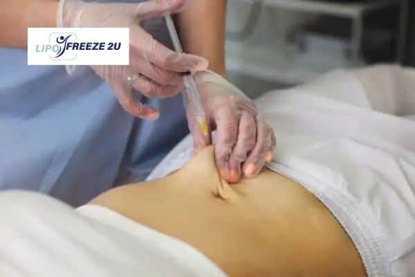 How Does Aqualyx Fat Dissolving Injection Work to Break Down Fat Folkestone?