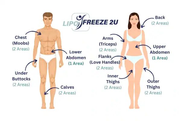 Areas you can have fat freezing treatment Folkestone