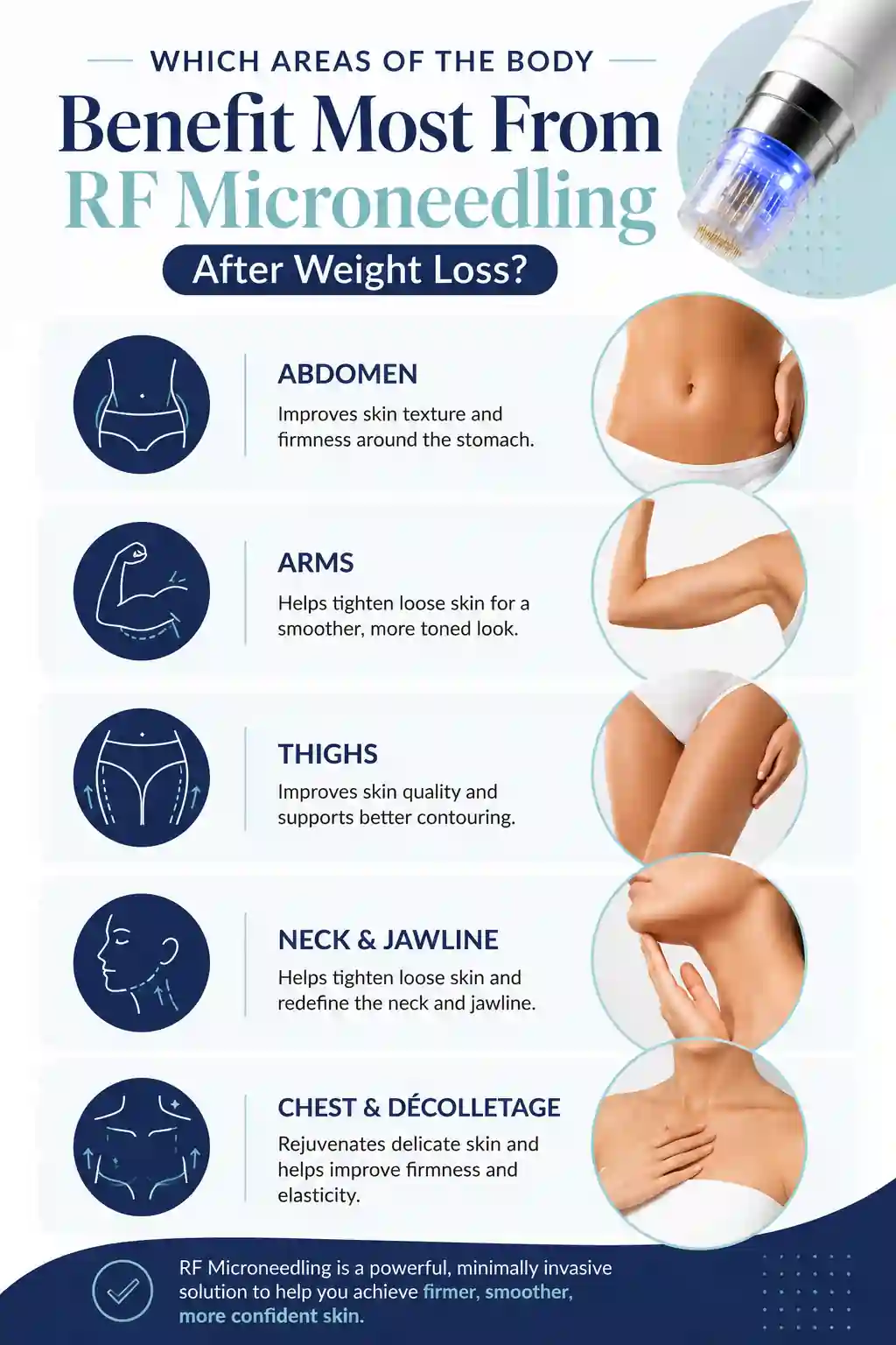 Which Areas of the Body Benefit Most From RF Microneedling After Weight Loss Folkestone